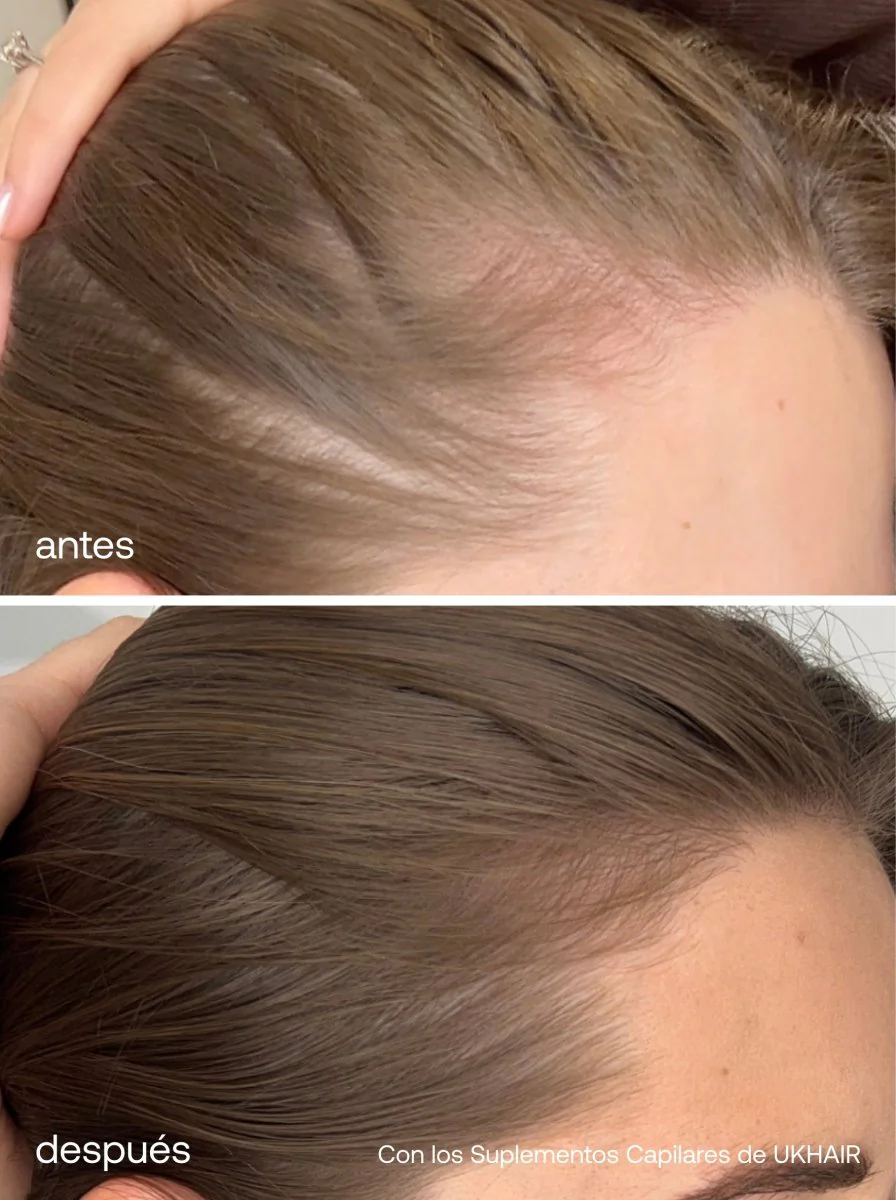 Sérum de Crecimiento del Cabello + Suplementos Capilares Avanzados + Advanced Scalp Dermaroller - Image 6