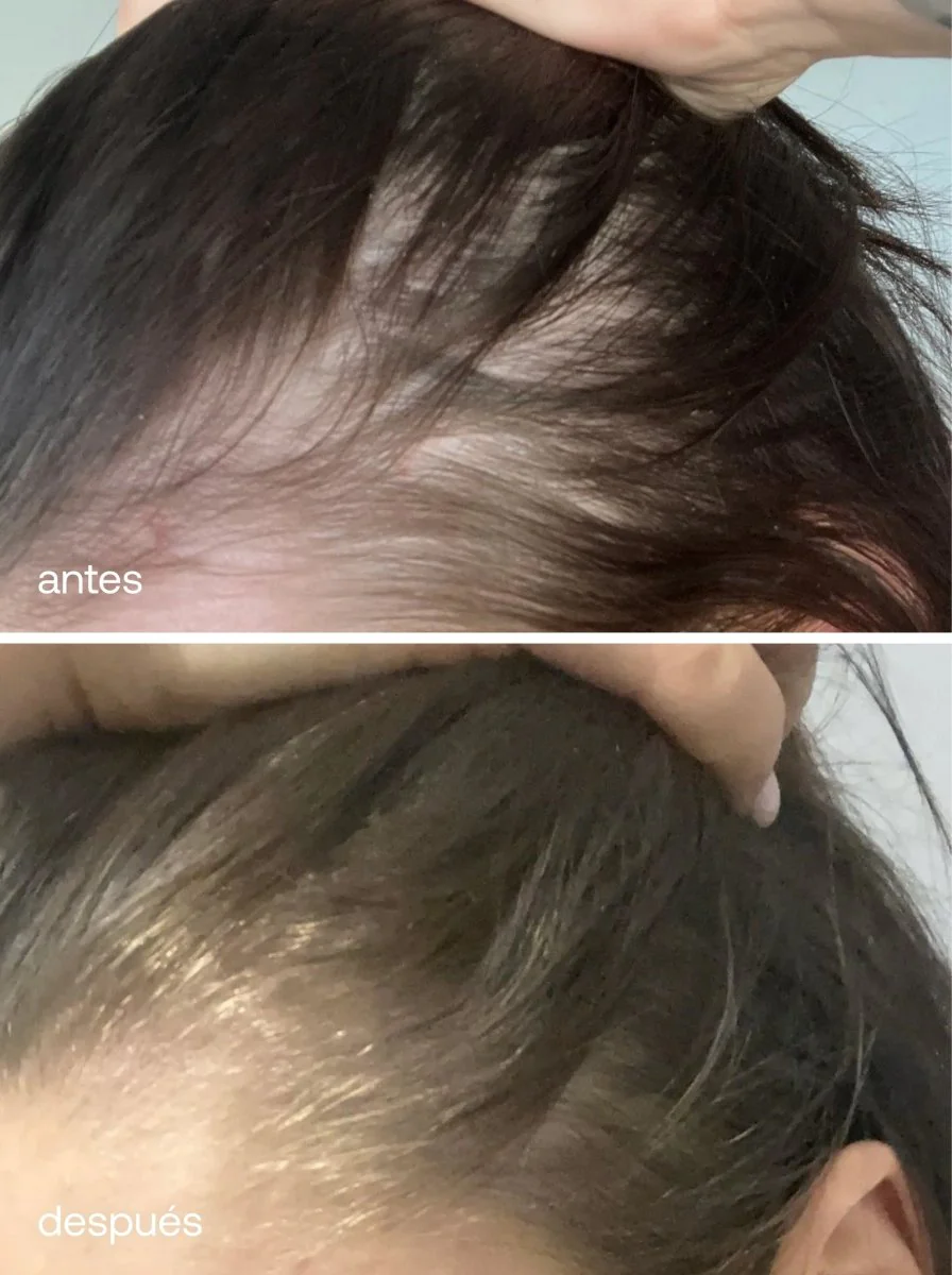 Vitaminas para el Cabello - Image 5